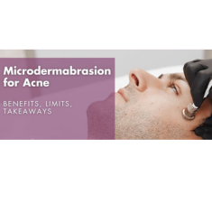 Microdermabrasion_img_3