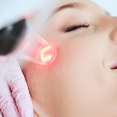 Laser Treatment_img_1