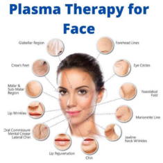 Platelet-Rich Plasma (PRP) Therapy_img_3