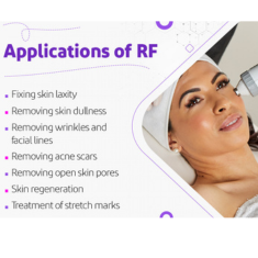 Radiofrequency (RF) Therapy_img_2